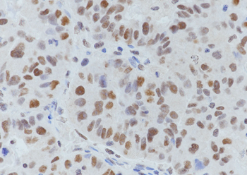 Acetyl-Histone H3 (Lys27) Rabbit Polyclonal Antibody