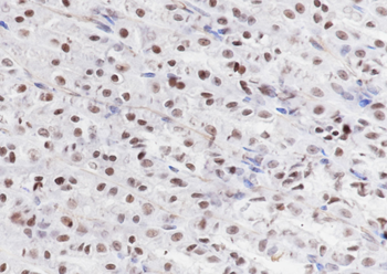 Mono-Methyl-Histone H3 (Lys79) Recombinant Rabbit Monoclonal Antibody