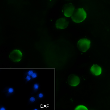 RAN Recombinant Mouse Monoclonal Antibody