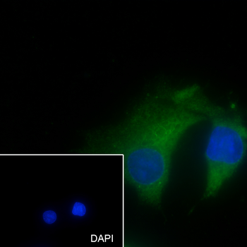 GCK Recombinant Mouse Monoclonal Antibody