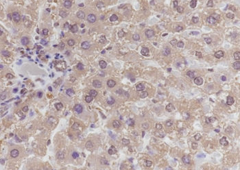 GCK Recombinant Mouse Monoclonal Antibody