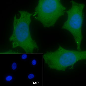 UGDH Recombinant Mouse Monoclonal Antibody