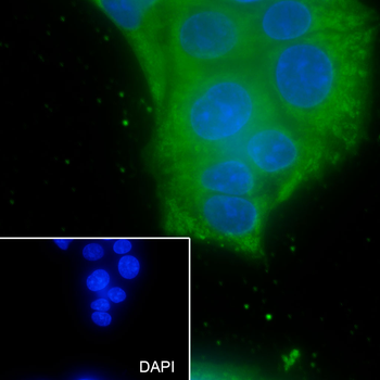 SLC9A9 Recombinant Mouse Monoclonal Antibody