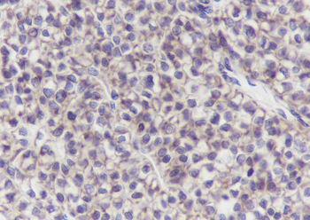 SLC9A9 Recombinant Mouse Monoclonal Antibody