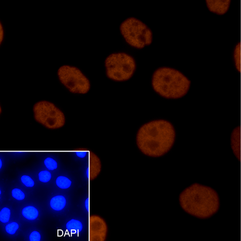 Propionyl-Histone H4 (Lys12) Rabbit Polyclonal Antibody