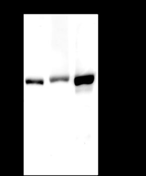 CPS1 Recombinant Rabbit Monoclonal Antibody