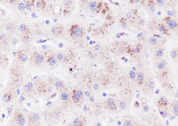 CPS1 Recombinant Rabbit Monoclonal Antibody