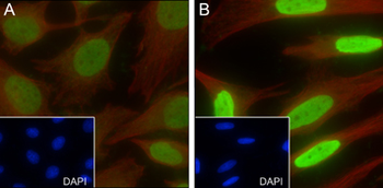 Butyryl-Histone H2B (Lys5) Rabbit Polyclonal Antibody