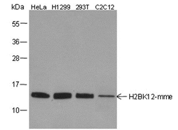 Mono-Methyl-Histone H2B (Lys12) Rabbit Polyclonal Antibody