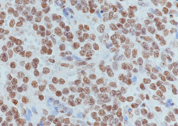 Tri-Methyl-Histone H3 (Lys79) Rabbit Polyclonal Antibody