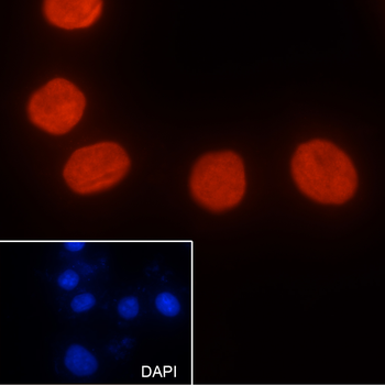 Di-Methyl-Histone H3 (Lys9) Rabbit Polyclonal Antibody
