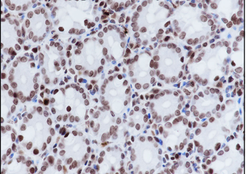 Di-Methyl-Histone H3 (Lys9) Rabbit Polyclonal Antibody