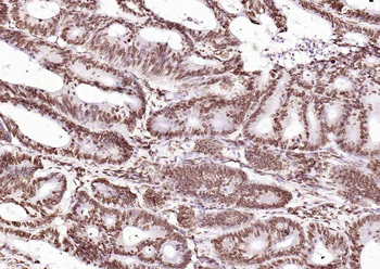 ERCC1 Recombinant Rabbit Monoclonal Antibody