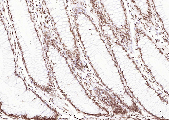 ERCC1 Recombinant Rabbit Monoclonal Antibody