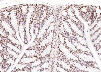 ERCC1 Recombinant Rabbit Monoclonal Antibody
