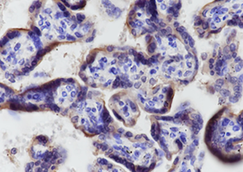 CFTR C-terminus Recombinant Mouse Monoclonal Antibody