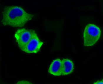 ACLY Recombinant Rabbit Monoclonal Antibody