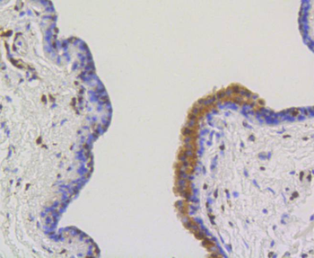 ACLY Recombinant Rabbit Monoclonal Antibody