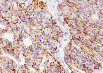 CLDN7 Recombinant Rabbit Monoclonal Antibody