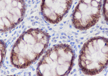 CLDN7 Recombinant Rabbit Monoclonal Antibody