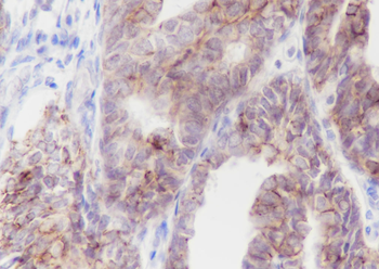 CLDN7 Recombinant Rabbit Monoclonal Antibody