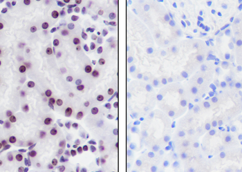 Histone H3 (Tri Methyl K36) Recombinant Rabbit Monoclonal Antibody