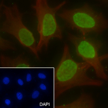 Di-Methyl-Histone H3 (Lys56) Recombinant Rabbit Monoclonal Antibody
