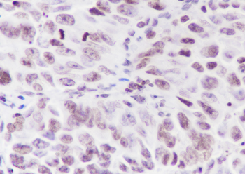 Di-Methyl-Histone H3 (Lys56) Recombinant Rabbit Monoclonal Antibody