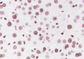 Di-Methyl-Histone H3 (Lys56) Recombinant Rabbit Monoclonal Antibody