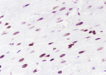 Di-Methyl-Histone H3 (Lys56) Recombinant Rabbit Monoclonal Antibody