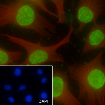 Mono-Methyl-Histone H3 (Lys36) Recombinant Rabbit Monoclonal Antibody