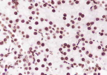 Mono-Methyl-Histone H3 (Lys36) Recombinant Rabbit Monoclonal Antibody