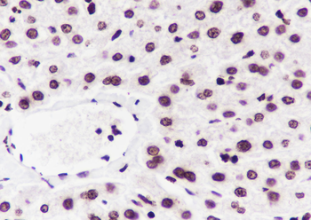 Di-Methyl-Histone H3 (Lys27) Recombinant Mouse Monoclonal Antibody