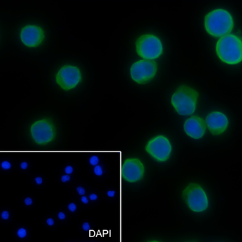 CD1d Recombinant Mouse Monoclonal Antibody