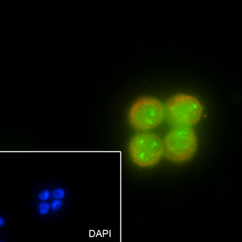 Fibrillarin Recombinant Rabbit Monoclonal Antibody