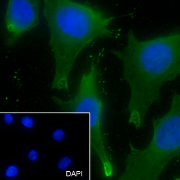 UPF1 Recombinant Mouse Monoclonal Antibody
