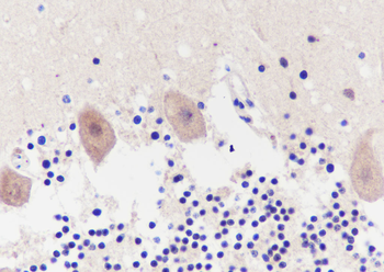 TMEM106B Recombinant Mouse Monoclonal Antibody