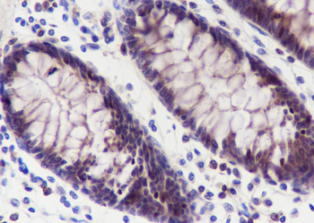 TMEM106B Recombinant Mouse Monoclonal Antibody