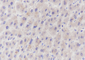 PRMT5 Recombinant Rabbit Monoclonal Antibody