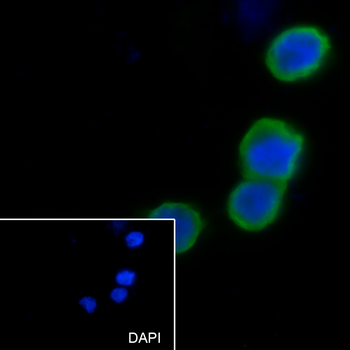 HLA-E Recombinant Mouse Monoclonal Antibody