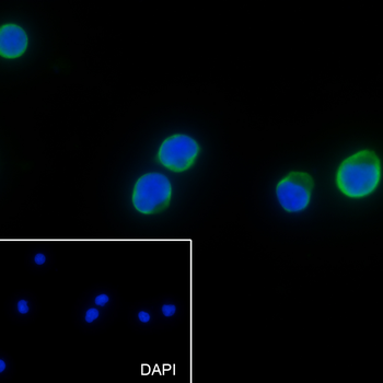 CD62L Recombinant Rabbit Monoclonal Antibody