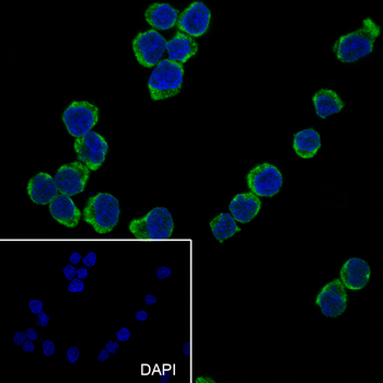 CD62L Recombinant Rabbit Monoclonal Antibody