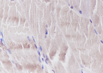 FLII Recombinant Mouse Monoclonal Antibody