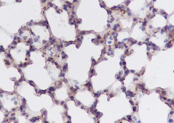 FLII Recombinant Mouse Monoclonal Antibody