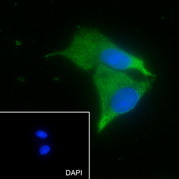 APOE Recombinant Mouse Monoclonal Antibody