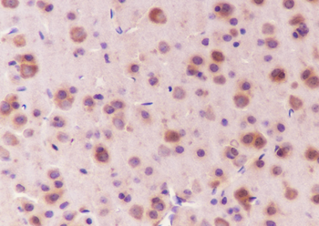 APOE Recombinant Mouse Monoclonal Antibody