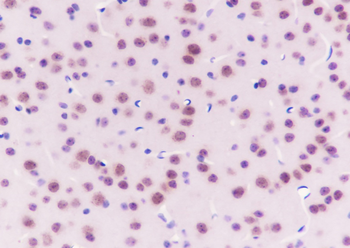 SMARCA2/BRM Recombinant Rabbit Monoclonal Antibody