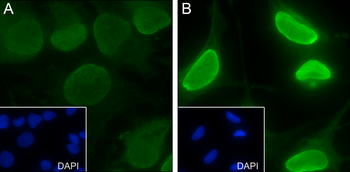 Butyryl-Histone H2B (Lys15) Rabbit Polyclonal Antibody