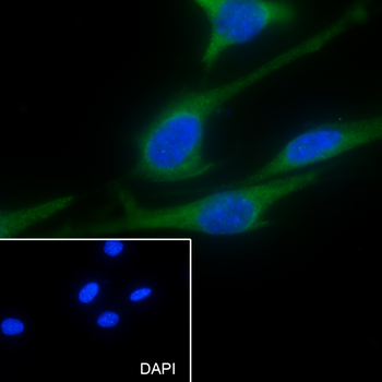 ABCE1 Recombinant Rabbit Monoclonal Antibody