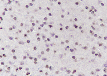 NUP62 Recombinant Mouse Monoclonal Antibody